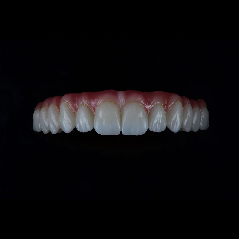 Full Coutour Zirconia Crown