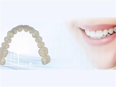 Dental Lab Outsourcing: fordeler, ulemper og viktige hensyn