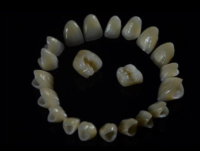 Dental Lab Zirconia Crowns: Kvalitet, prosess og hva du skal se etter i et la...
