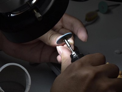 Hvor lenge varer PFM-kroner? Gjennomsnittlig levetid, faktorer og pleietips